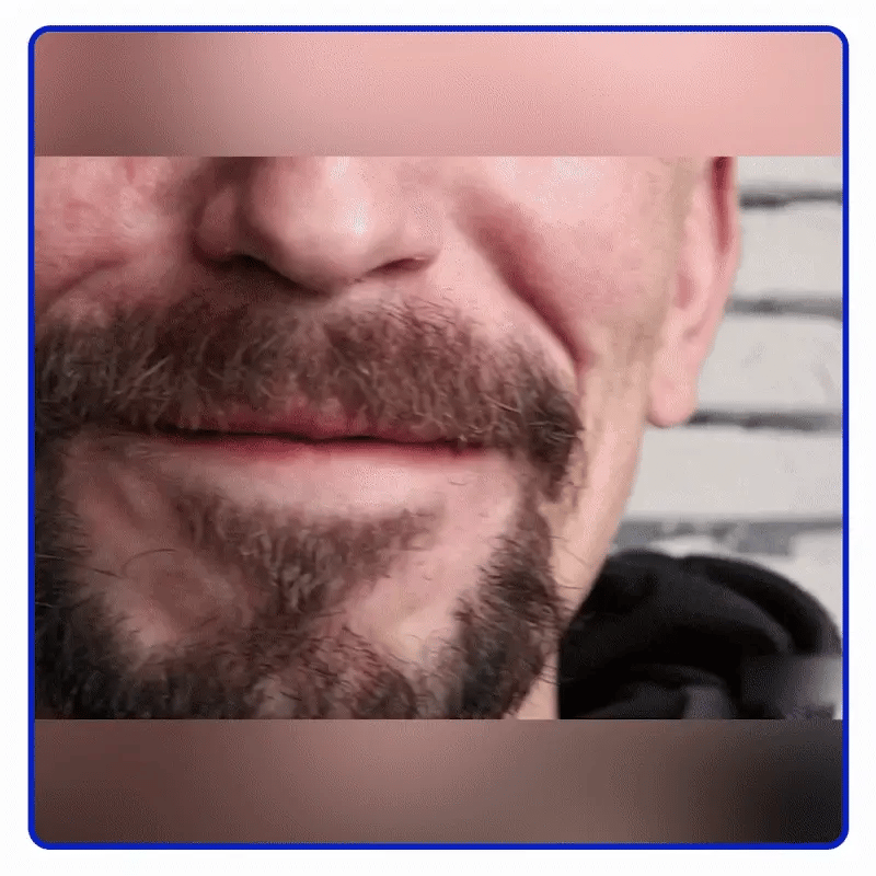 ✨ Recupera tu sonrisa natural en 20 días